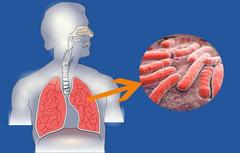 Чем опасен туберкулез?