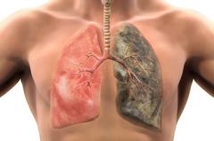 Туберкулез – болезнь коварная